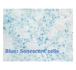 Figure 1. Small intestinal organoids in which cellular senescence was induced