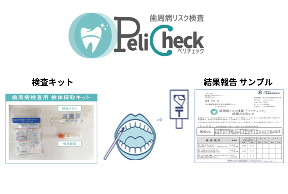 歯周病リスク検査